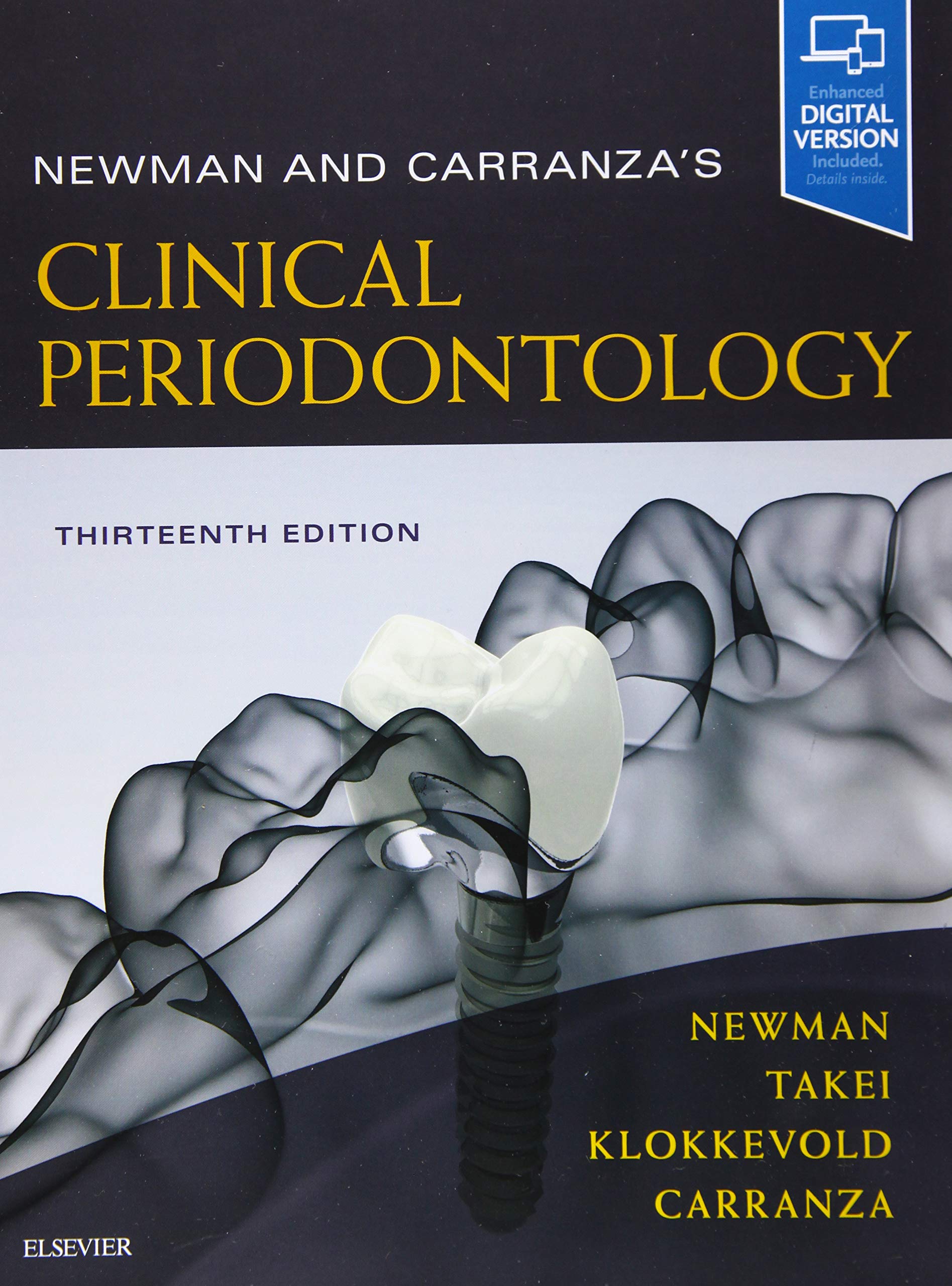 Caranza's Periodontology